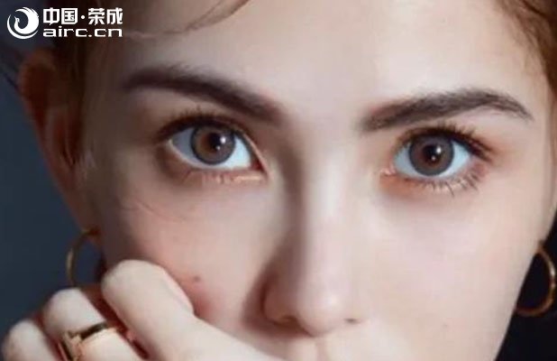 <b>睿辰科普  什么樣的眼睛適合割雙眼皮？</b>