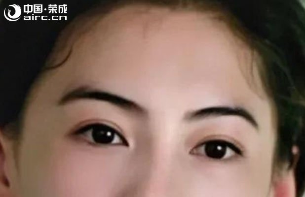 <b>睿辰科普  抗衰不“膚淺”，分層抗衰才是根本</b>