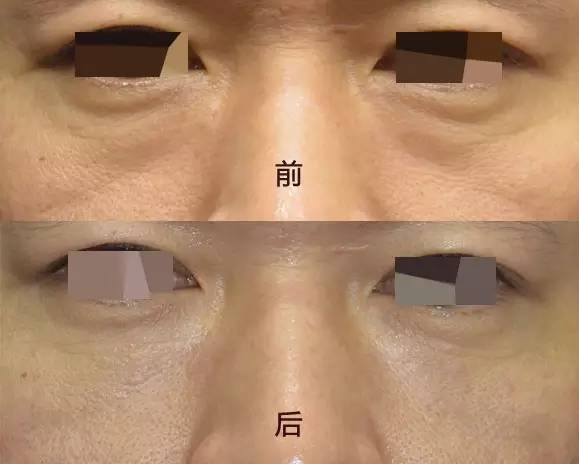 sɌO | Ęǂ(g)PQ߀۴Լ](mi)c(din)x(sh)