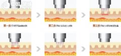 ʲôSl΢ᘣ##